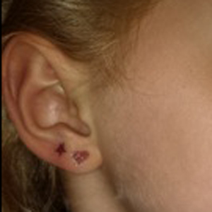 ear-ink tattoo on 6 year old ear